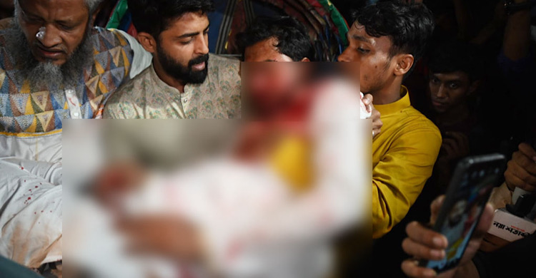 জাপা কার্যালয়ের সামনে সংঘর্ষে গুরুতর আহত নুরুল হক নুর