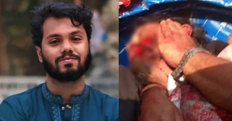 হাদির সাথে সিঙ্গাপুর যাচ্ছেন তার দুই ভাই