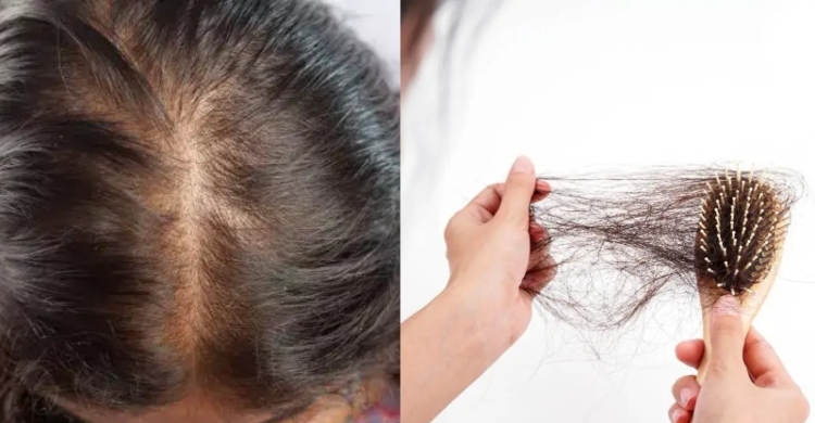 ঘরোয়া উপায়ে চুল পড়া কমান