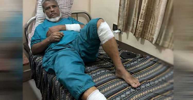 হকিস্টিক দিয়ে পিটিয়ে বিএনপি নেতার হাত-পা ভেঙে দিলো দুর্বৃত্তরা