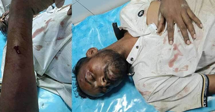 হিরো আলমের ওপর দুর্বৃত্তদের হামলা